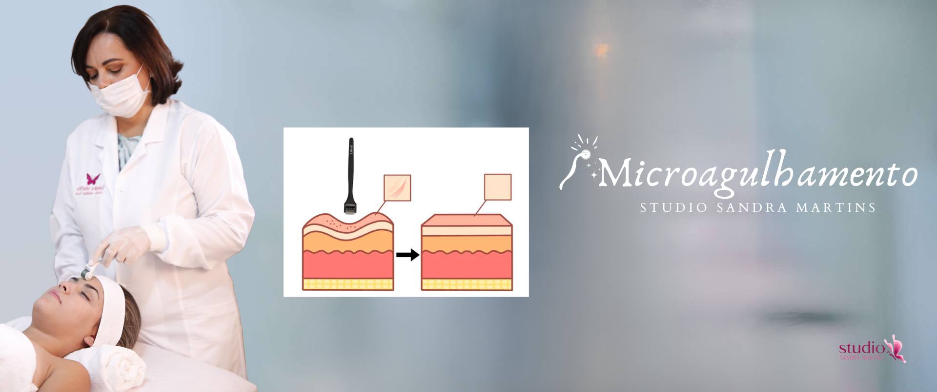 O microagulhamento é uma técnica moderna e eficaz para quem busca resultados duradouros e naturais.