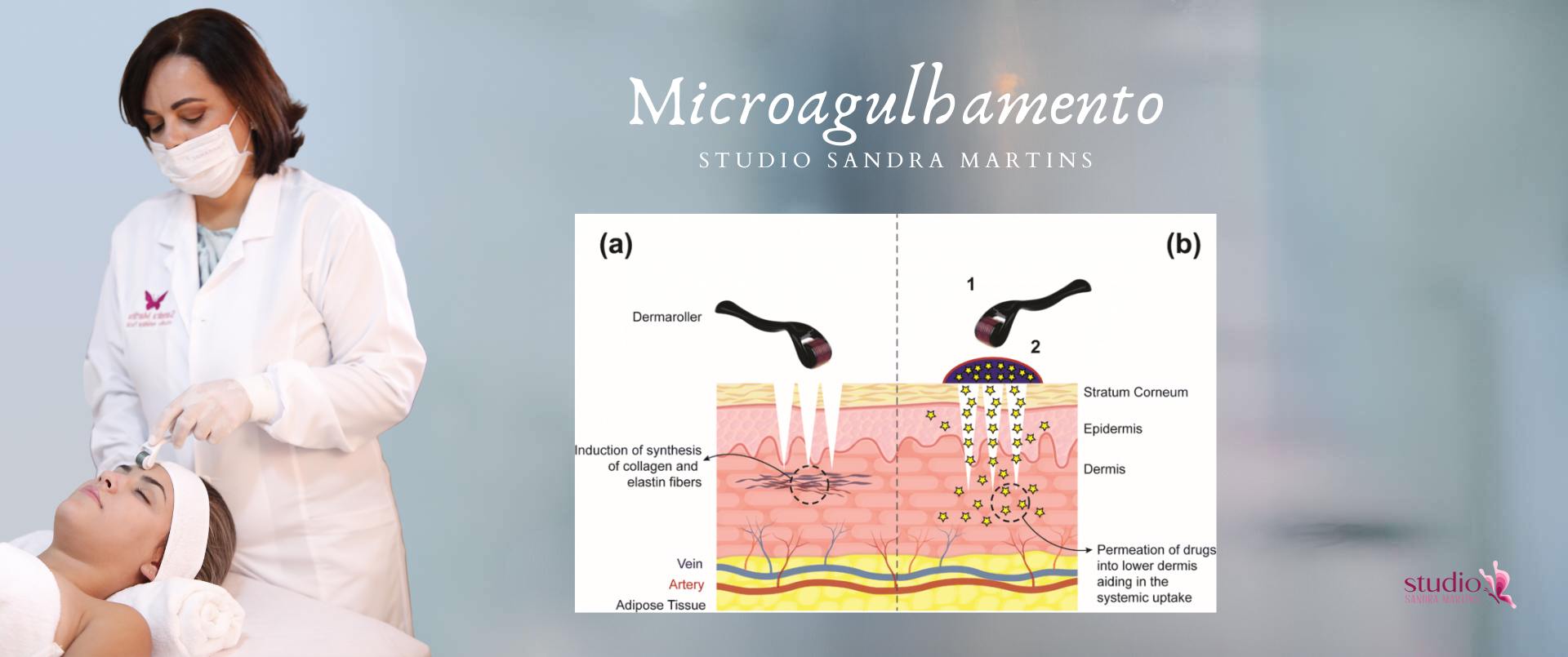 Microagulhamento com Dermaroller: O rolo que rejuvenesce e transforma a pele