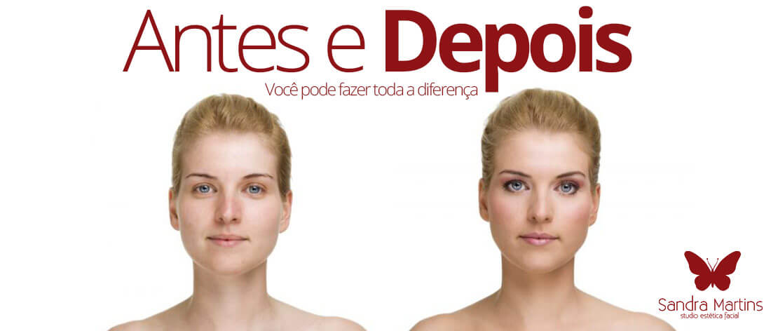 antes e depois de algumas DIVAS e DIVOS que já realizaram tratamentos estéticos faciais no Studio Sandra Martins, como: limpeza de pele, peeling de diamante, peeling químico, tratamento contra acne, design de sobrancelha e depilação facial com linha
