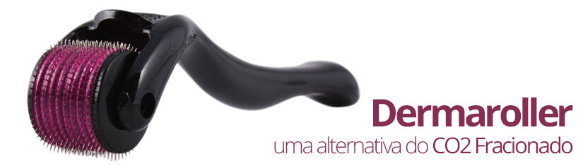 O Dermaroller ou Microagulhamento é um método simples e natural de regeneração da pele e com iguais ou melhores resultados que o CO2 fracionado. A técnica de microagulhamento é uma terapia por indução de colágena, ela estimula a produção de colágeno, além de aumentar em 40% a absorção de ativos potencializando a ação dos mesmos.
