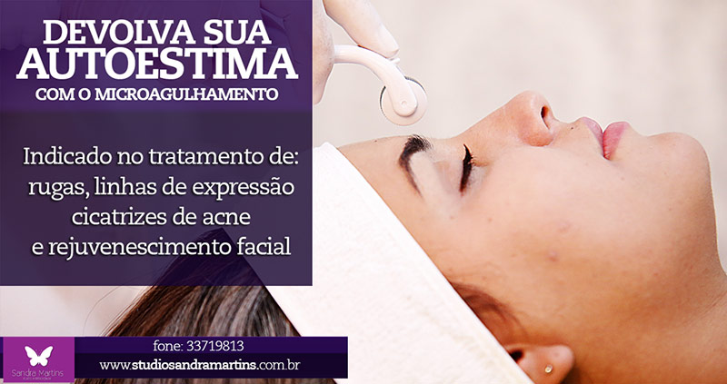 Em menos de 6 meses mais de 20 tratamentos de microagulhamento realizados no Studio Sandra Martins de Estética Facial. O público de Brasília e DF procurando esse inovação para a renovação da pele do rosto.