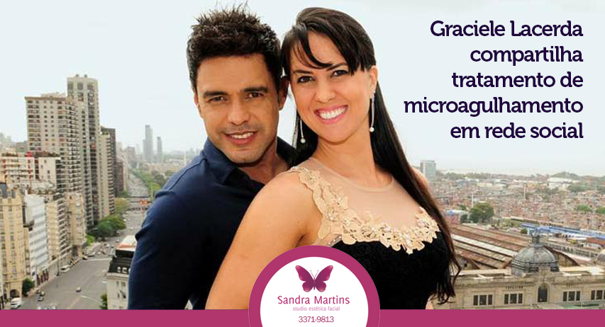 Não é de hoje que personalidades e atrizes aderiram ao tratamento de microagulhamento para melhorar a textura da pele do rosto em Brasília