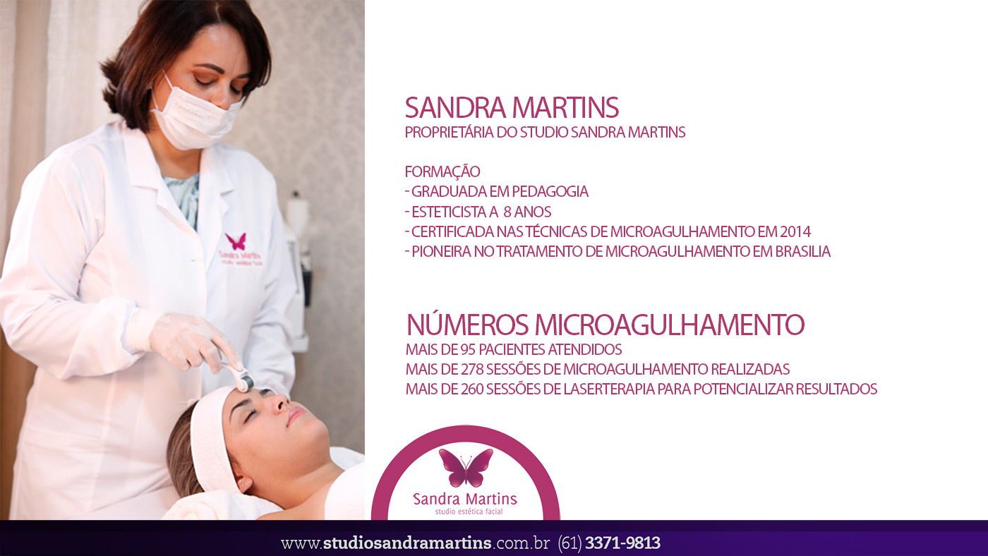 Onde fazer tratamento de melasma com dermaroller em Taguatinga? maio 5, 2024 Studio Sandra Martins de Estética Facial