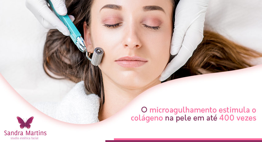 Você sabia que um dos principais trunfos do microagulhamento é o de estimular o colágeno da pele em até 400 vezes?