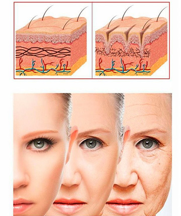 Microagulhamento para rejuvenescimento da pele do rosto em Brasília maio 1, 2024 Studio Sandra Martins de Estética Facial