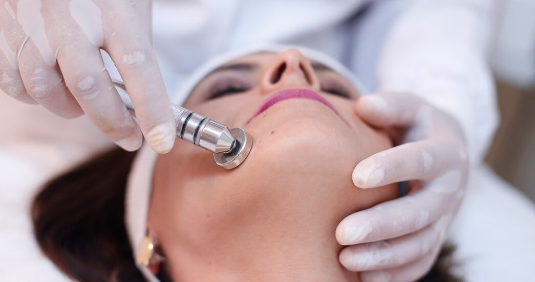 Peeling esteticista de Brasília explica benefícios de cuidar da pele durante todo o ano! Seja com peeling mecanico ou peeling químico para manchas