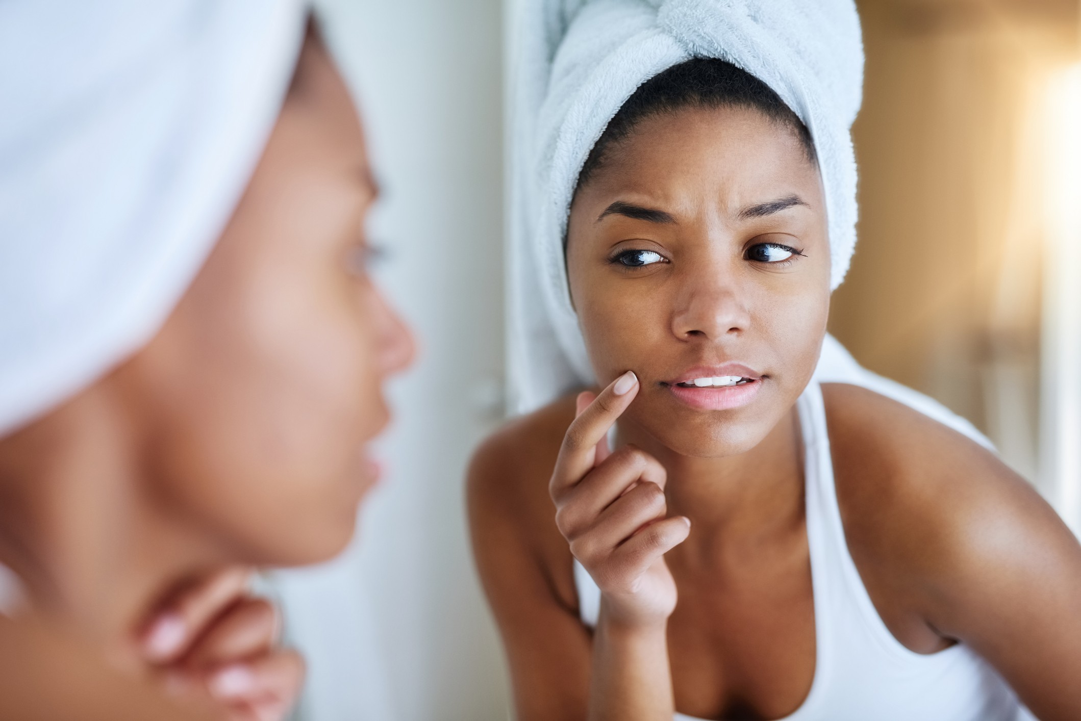 Acne como a dieta e a genética interferem no surgimento de espinhas! Dicas valiosas para você cuidar da sua pele em qualquer época do ano!