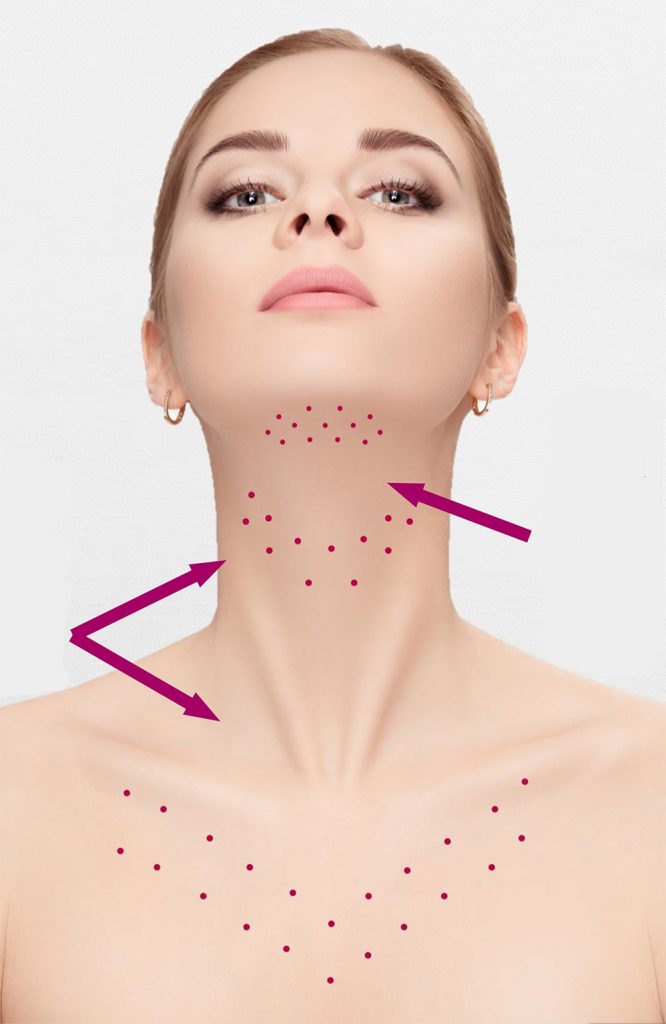 Harmonização facial de papada, pescoço e colo com microagulhamento maio 21, 2022 Studio Sandra Martins de Estética Facial Conheça o revolucionário tratamento estético facial de microagulhamento para harmonização de papada e de lifting de pescoço e colo do Studio Sandra Martins em Brasília