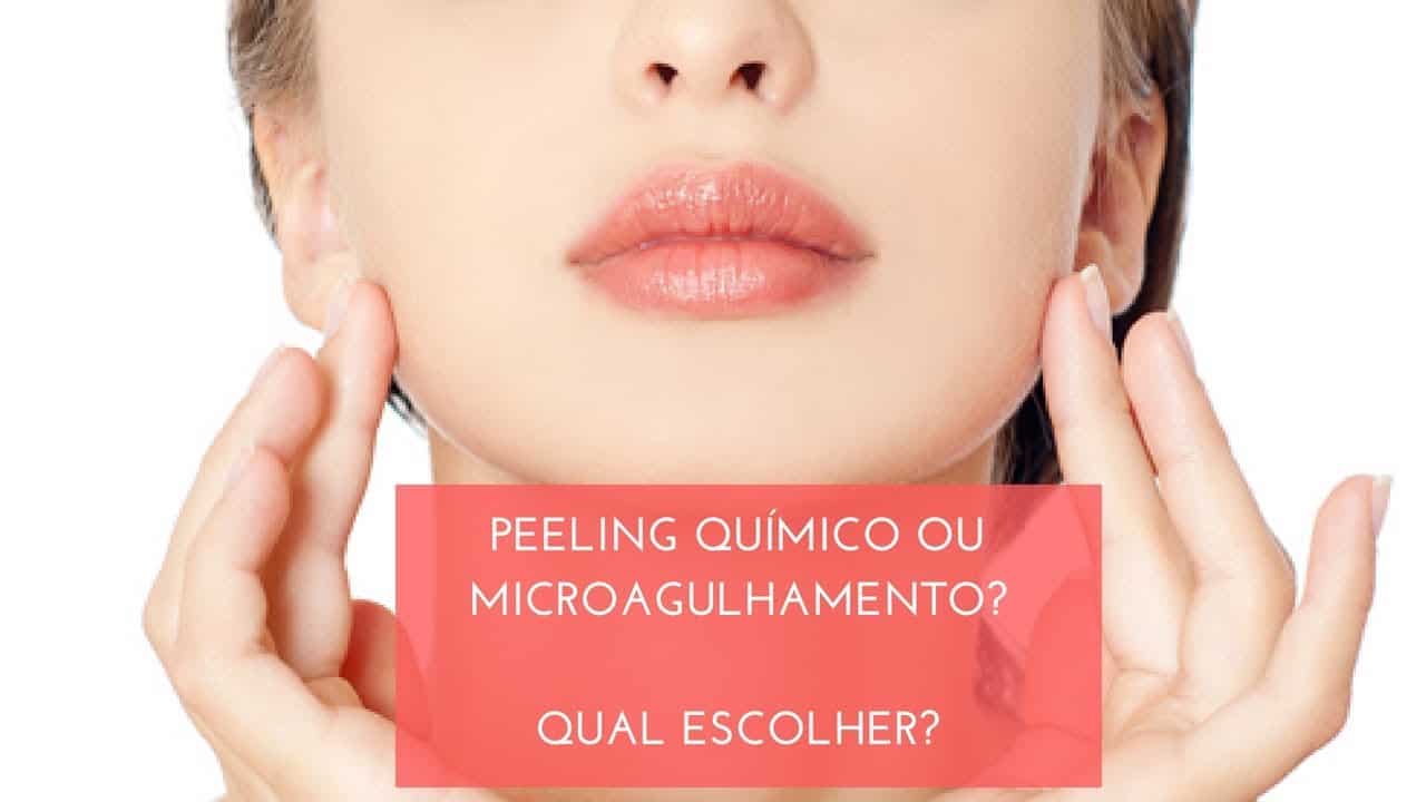 O microagulhamento é uma técnica desenvolvida especialmente para o tratamento de rugas, cicatrizes (principalmente de acne), estrias, flacidez e hipercromias, por meio de perfurações na pele feitas por um cilindro com microagulhas. 