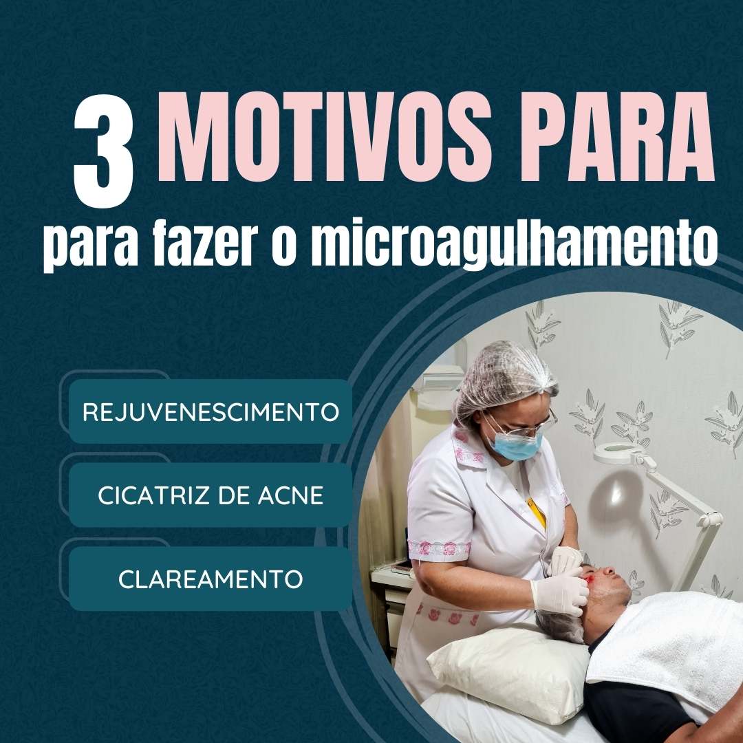 Desde 2014 o Studio Sandra Martins em Taguatinga realiza o microagulhamento em Brasília! Conheça os benefícios do microagulhamento.