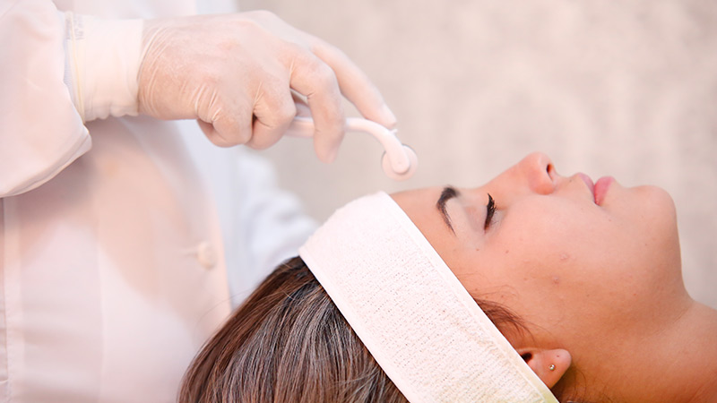 O microagulhamento facial é uma técnica para tratamento estético na face para diminuir cicatriz de acne, manchas e marcas de expressão ou da idade. O procedimento é aplicado através do Dermaroller ou Doctor Roller com a finalidade de renovar a pele, por meio das microagulhas. E em Brasília você pode realizar esse procedimento no Studio Sandra Martins em Taguatinga!
