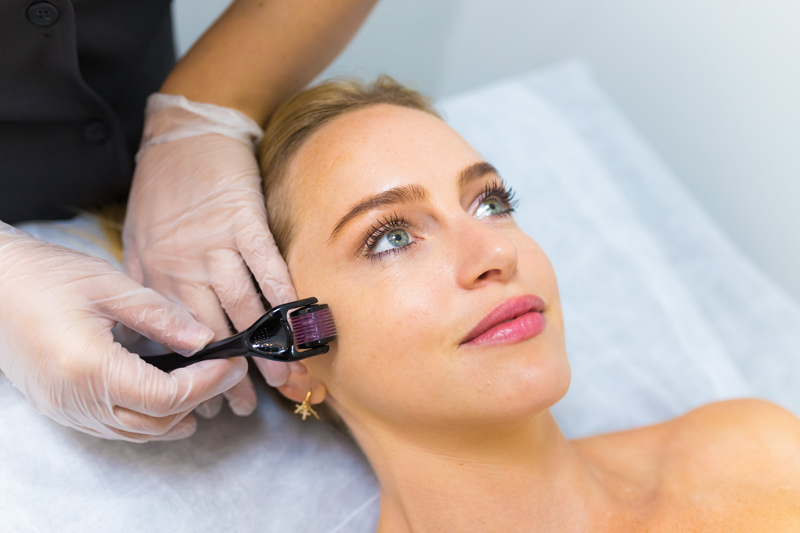 Transforme sua pele neste inverno: os benefícios do microagulhamento em Brasília no Studio Sandra Martins