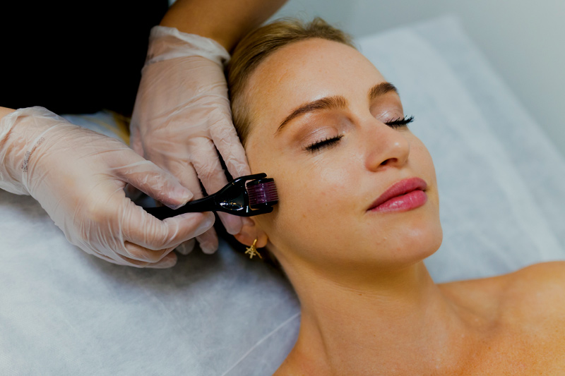 Você sabia que pode realizar o tratamento para cicatriz de acne, em Taguatinga, com microagulhamento no Studio Sandra Martins de Estética Facial?