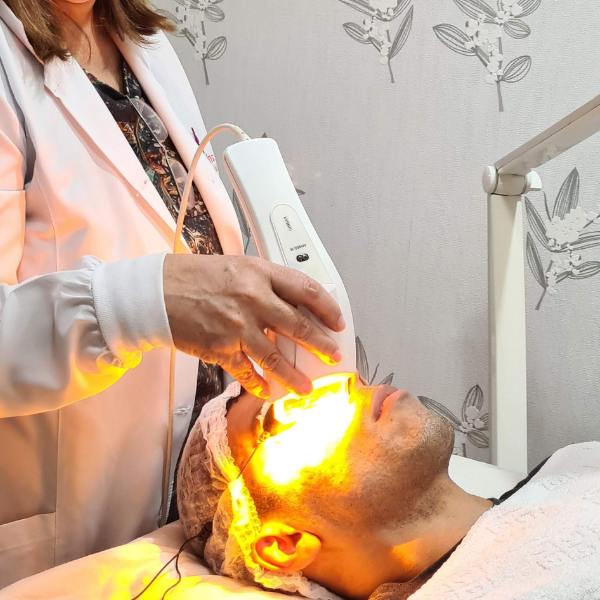 Promoção 2: Limpeza de pele com Laser - R$ 180,00 em Taguatinga